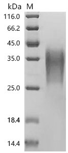 Human TGF-beta receptor type-2 (TGFBR2), partial Recombinant Protein, Homo sapiens (Human), Mammalian cell, C-terminal 10xHis-tagged, 16.8 kDa, purity >≥ 95% as determined by SDS-PAGE.≥ 90% as determined by SEC-HPLC.