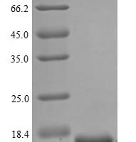Human Proliferation marker protein Ki-67 (MKI67), partial Recombinant Protein, N-His, aa 3120–3256 - BioCrest Sci