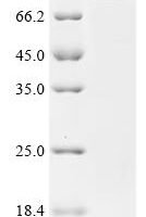 Mouse Bifunctional 3'-5' exonuclease/ATP-dependent helicase WRN (Wrn), partial Recombinant Protein - BioCrest Sci