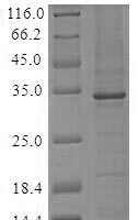 Human Complement C1q subcomponent subunit A (C1QA) Recombinant Protein, N-10His/C-Myc, aa 23–245, Baculovirus - BioCrest Sci