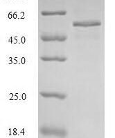 Human Pulmonary surfactant-associated protein B (SFTPB) Recombinant Protein, N-MBP - BioCrest Sci