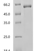 Human E3 ubiquitin-protein ligase TRIM21 (TRIM21) Recombinant Protein - BioCrest Sci