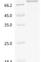 Human Z-DNA-binding protein 1 (ZBP1) Recombinant Protein, C-GST - BioCrest Sci