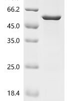 Mouse Sprouty-related, EVH1 domain-containing protein 1 (Spred1) Recombinant Protein - BioCrest Sci
