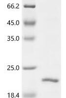Cat Beta-2-microglobulin (B2M) Recombinant Protein, C-His, aa 21–118, E.coli - BioCrest Sci