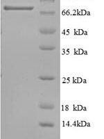 Human  Tumor protein 63 (TP63) Recombinant Protein - BioCrest Sci