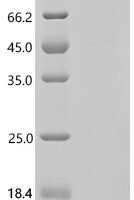 Human Amyloid-beta A4 precursor protein-binding family A member 2 (APBA2) Recombinant Protein, C-His - BioCrest Sci