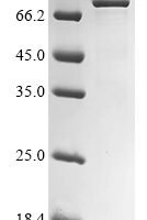 Human RNA-binding protein FXR1 (FXR1) Recombinant Protein, C-His - BioCrest Sci