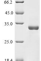Penicillium citrinum Nuclease P1 Recombinant Protein, N-His, aa 1–270, E.coli - BioCrest Sci