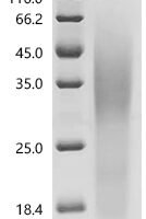 Human Seizure protein 6 homolog (SEZ6), partial Recombinant Protein, C-10His, aa 528–591, Yeast - BioCrest Sci