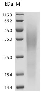 Human Seizure protein 6 homolog (SEZ6), partial Recombinant Protein, C-10His, aa 528–591, Yeast, Homo sapiens (Human), Yeast, C-terminal 10xHis-tagged, 9.2 kDa, purity >≥ 95% as determined by SDS-PAGE.