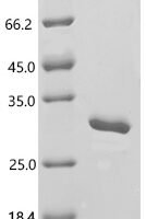 Human Abhydrolase domain-containing protein 14B (ABHD14B) Recombinant Protein, C-His - BioCrest Sci
