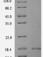 Mouse Thioredoxin domain-containing protein 12 (Txndc12) Recombinant Protein, N-His, aa 25–170, Yeast - BioCrest Sci