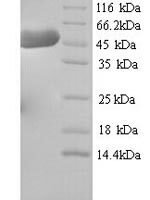 Mouse Hydroxymethylglutaryl-CoA synthase, Cytoplasmic domain (Hmgcs1) Recombinant Protein - BioCrest Sci