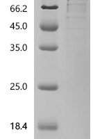Mouse Perilipin-2 (Plin2) Recombinant Protein, C-hFc1 - BioCrest Sci