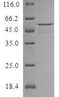 Human Cysteine-rich secretory protein LCCL domain-containing 2 (CRISPLD2) Recombinant Protein, N-10His/C-Myc - BioCrest Sci