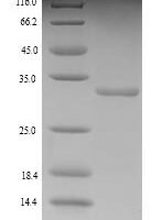 Rat Kinesin-like protein KIF1C (Kif1c), partial Recombinant Protein - BioCrest Sci