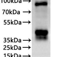 Human Thyrotropin receptor (TSHR), partial-VLPs Recombinant Protein - BioCrest Sci