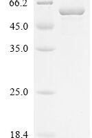 Human Kinesin-1 heavy chain (KIF5B), partial Recombinant Protein, N-10His - BioCrest Sci