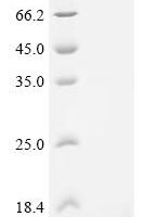 Mycobacterium tuberculosis Meromycolate extension acyl carrier protein (acpM) Recombinant Protein, C-His - BioCrest Sci