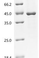 Mouse Transforming growth factor beta-1 proprotein (Tgfb1) Recombinant Protein - BioCrest Sci