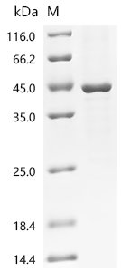 Mouse Transforming growth factor beta-1 proprotein (Tgfb1) Recombinant Protein, Mus musculus (Mouse), E.coli, N-terminal 6xHis-tagged, 45.4 kDa, purity >≥ 85% as determined by SDS-PAGE.