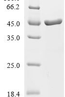Stenotrophomonas maltophilia dTDP-glucose 4,6-dehydratase (rmlB) Recombinant Protein - BioCrest Sci