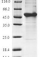 Human BTB/POZ domain-containing protein KCTD15 (KCTD15) Recombinant Protein - BioCrest Sci