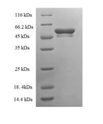 Mouse Tryptase beta-2 (Tpsb2) Recombinant Protein - BioCrest Sci