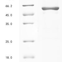 Human Pyruvate kinase PKM (PKM), partial Recombinant Protein - BioCrest Sci