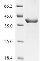 Schmidtea mediterranea Activin 2, partial Recombinant Protein - BioCrest Sci