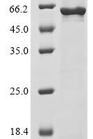 Human Cell division cycle protein 20 homolog (CDC20) Recombinant Protein - BioCrest Sci