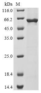 Human Cell division cycle protein 20 homolog (CDC20) Recombinant Protein, Homo sapiens (Human), E.coli, N-terminal 10xHis-tagged and C-terminal Myc-tagged, 62.2 kDa, purity >≥ 85% as determined by SDS-PAGE.