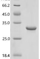 Mouse Neuronal acetylcholine receptor subunit alpha-7 (Chrna7), partial Recombinant Protein, C-His - BioCrest Sci