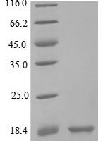 Human Interleukin-2 (IL2) Recombinant Protein, C-His - BioCrest Sci