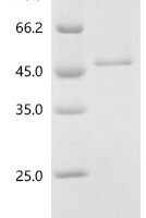 Human Deoxyribonuclease gamma (DNASE1L3) Recombinant Protein, N-His - BioCrest Sci