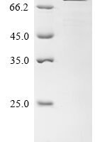 Human Transcriptional coactivator YAP1 (YAP1) Recombinant Protein, C-His - BioCrest Sci