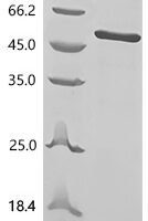 Human papillomavirus type 6 Regulatory protein E2 (E2) Recombinant Protein - BioCrest Sci