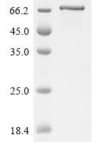 Mouse Cadherin-11 (Cdh11), partial Recombinant Protein - BioCrest Sci