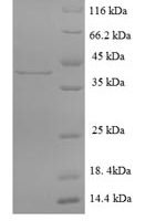 Mouse Cathepsin G (Ctsg) Recombinant Protein - BioCrest Sci