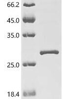strain ZH-548 M12 Nucleoprotein (N) Recombinant Protein - BioCrest Sci