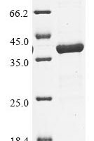 Legionella pneumophila Aspartate-semialdehyde dehydrogenase (asd) Recombinant Protein - BioCrest Sci