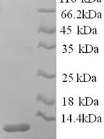 Rat Apolipoprotein C-III (Apoc3) Recombinant Protein - BioCrest Sci