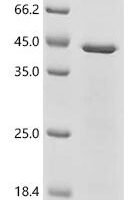 Feline calicivirus Capsid protein VP1, partial Recombinant Protein - BioCrest Sci