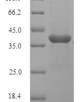 Rat Lumican (Lum) Recombinant Protein, N-His, aa 19–338, Mammalian cell - BioCrest Sci