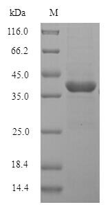 Rat Lumican (Lum) Recombinant Protein, N-His, aa 19–338, Mammalian cell, Rattus norvegicus (Rat), Mammalian cell, N-terminal 6xHis-tagged, 40.5 kDa, purity >≥ 90% as determined by SDS-PAGE.