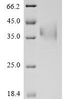 Bovine coronavirus Spike glycoprotein (S), partial Recombinant Protein, C-His, aa 314–634, strain 98TXSF-110-ENT - BioCrest Sci