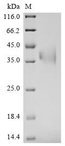 Bovine coronavirus Spike glycoprotein (S), partial Recombinant Protein, C-His, aa 314–634, strain 98TXSF-110-ENT, Bovine coronavirus (strain 98TXSF-110-ENT) (BCoV-ENT) (BCV), Yeast, C-terminal 6xHis-tagged, 36.6 kDa, purity >≥ 90% as determined by SDS-PAGE.