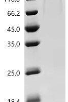 African swine fever virus CD2 homolog, partial Recombinant Protein - BioCrest Sci