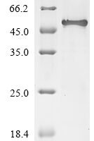 Human Inter-alpha-trypsin inhibitor heavy chain H3 (ITIH3), partial Recombinant Protein - BioCrest Sci